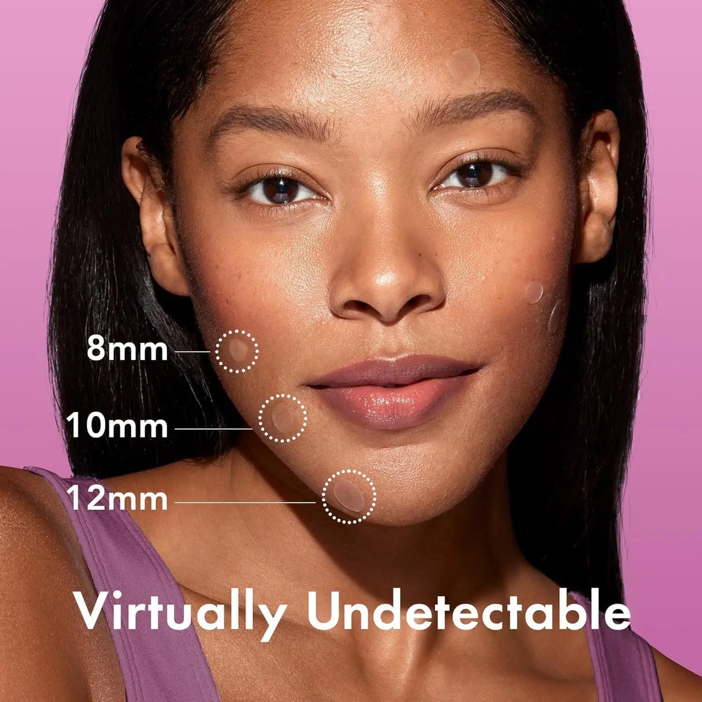 Rael Pimple Patches, Miracle Overnight Spot Cover - Hydrocolloid Acne Patch for Face, Zit & Blemish, Thicker & Extra Adhesion