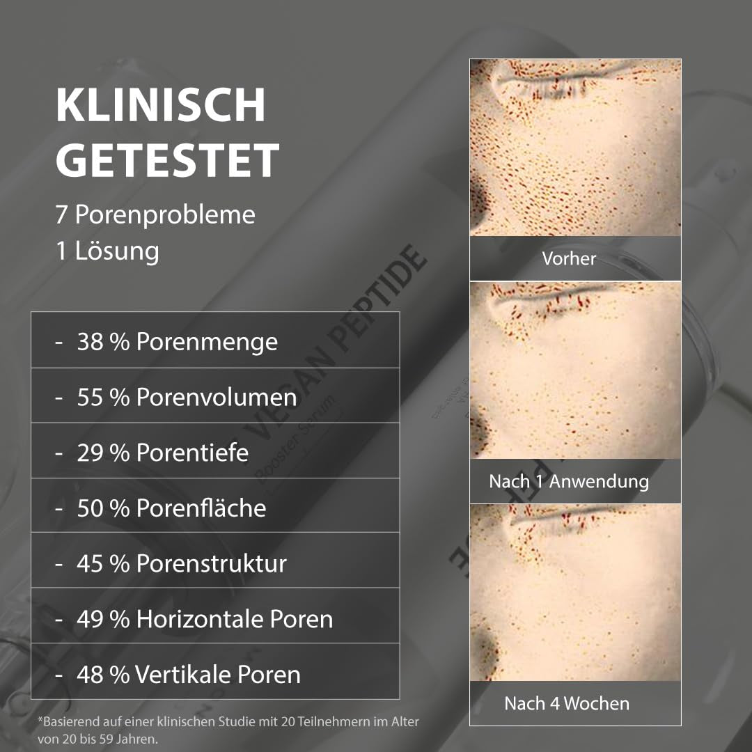 [MIZON] 7 VEGAN PEPTIDE BOOSTER SERUM (150Ml) Koreanische Pflege – Glas-Haut in 7 Sekunden – Porenreduzierung – 7 Lösungen Gegen Hautunregelmäßigkeiten – Hydratiert & Verleiht Ihrer Haut Neuen Glanz
