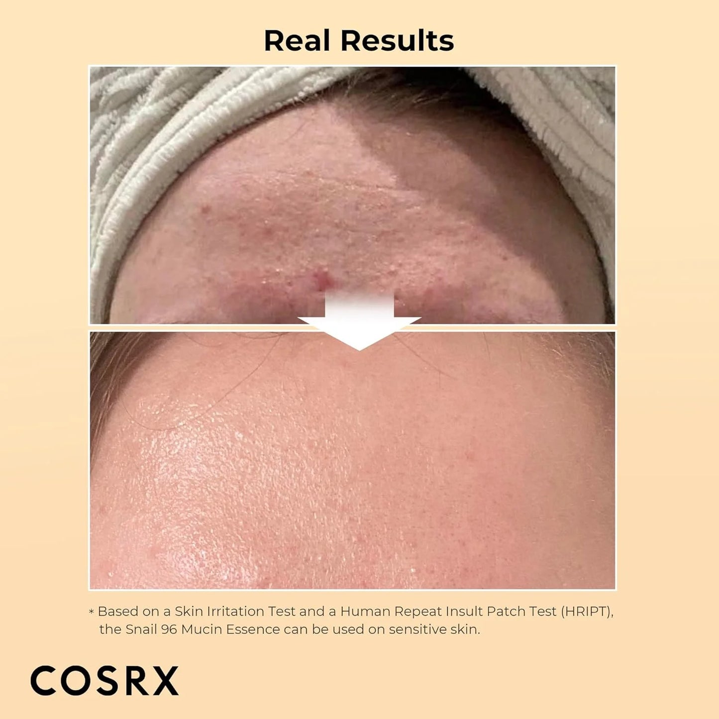 K-Beauty COSRX Advanced Snail 96 Mucin Power Essence | Hydrating & Repairing Facial Treatment