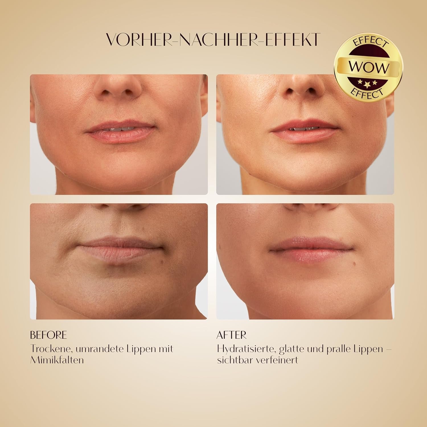 BIOBOTOX Goldene Lippenmaske Mit Mikrokristallen | Lippenpflege Mit Sofortiger Aufpolsterung, Anhebung, Hydratisierung & Faltenglättung | SNAP-8 Peptid & Acmella Oleracea | Made in Italy | 1 Stk.