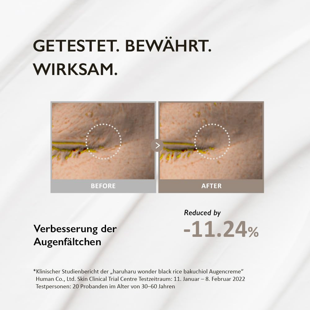 Wonder Black Reis Bakuchiol Augencreme 0,67 Fl.Oz / 20Ml | Anti-Aging, Faltenpflege, Natürliche Retinol-Alternative | Tierversuchsfrei, Ewg-Grün